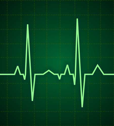 Readout from an ECG (electrocardiogram) monitoring a patient's heart, part of the services provided by Dr. Reuben Elovitz and the team at Private Health Dallas as part of their concierge care and annual physical exam.